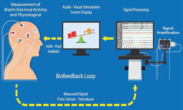 Neurofeedback Biofeedback loop